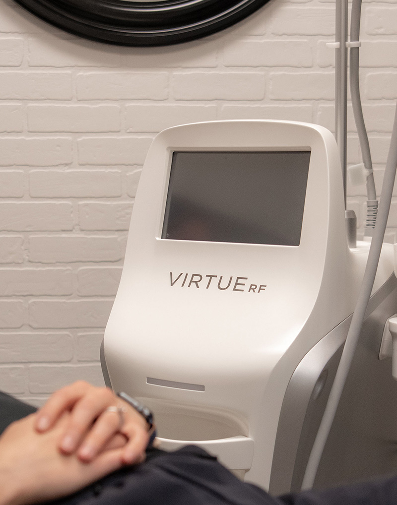 Virtue RF Microneedling in Bismark, ND